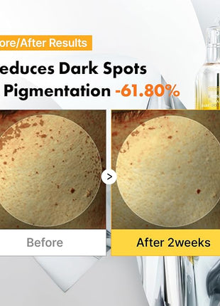 Exosome Mela-Glu Dark Spot Ampoule | Anti-Pollution Toning Pad